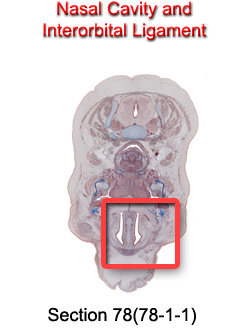 Nasal Cavity and Interorbital Ligament