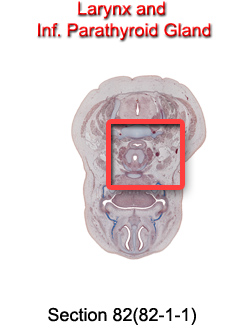 Larynx and Inf. Parathyroid Gland