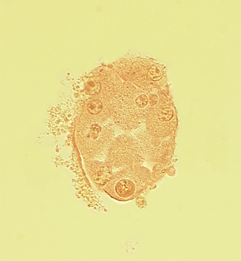 disrupted zona pellucida, edge of blastocystic cavity (blastocoele), nucleus of embryoblast (pluriblast), subzonal space