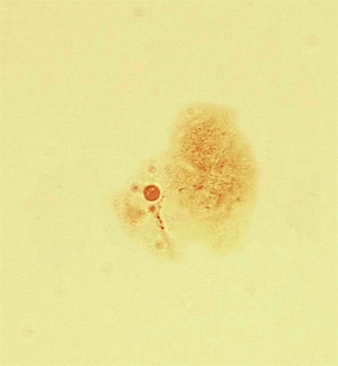 grazing section through edge of trophoblast