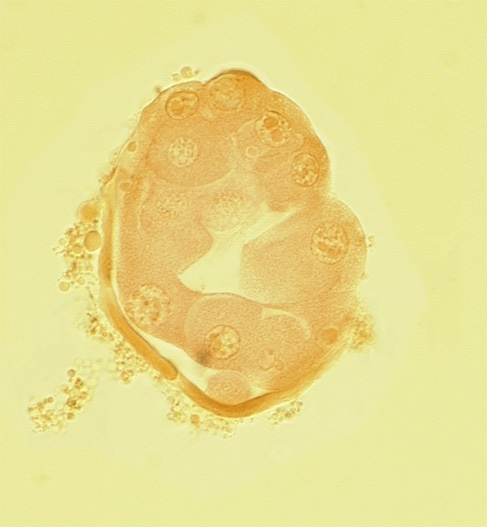 abembryonic pole, blastocystic cavity (blastocoele), disrupted zona pellucida, edge of inner cell mass (embryoblast), embryonic pole, mural trophoblast, polar body, polar trophoblast