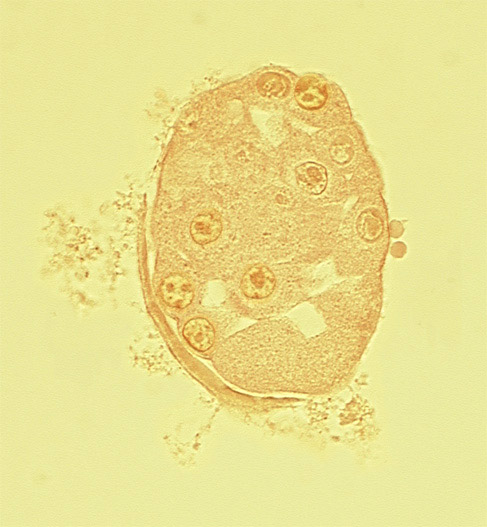 blastocystic cavity (blastocoele), cytoplasm of polar trophoblast, disrupted zona pellucida, mural trophoblast, nucleus of embryoblast (pluriblast), subzonal space