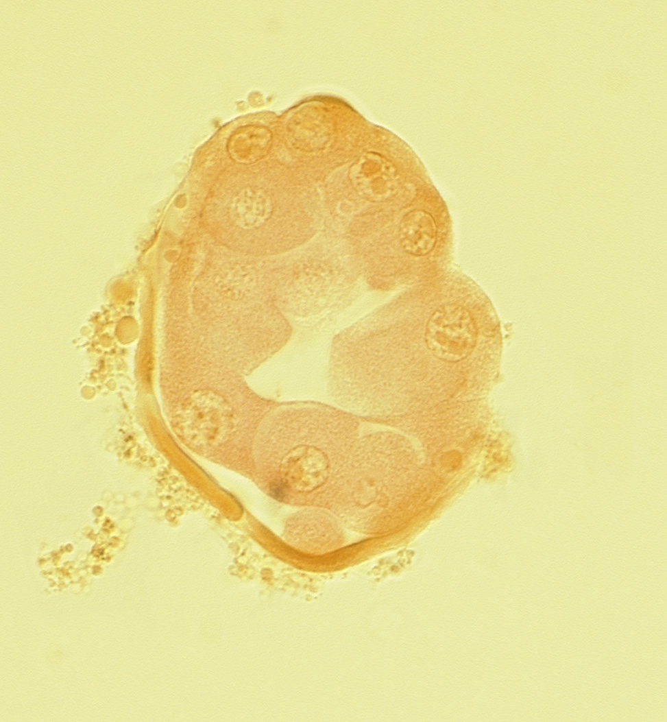 abembryonic pole, blastocystic cavity (blastocoele), disrupted zona pellucida, edge of inner cell mass (embryoblast), embryonic pole, mural trophoblast, polar body, polar trophoblast