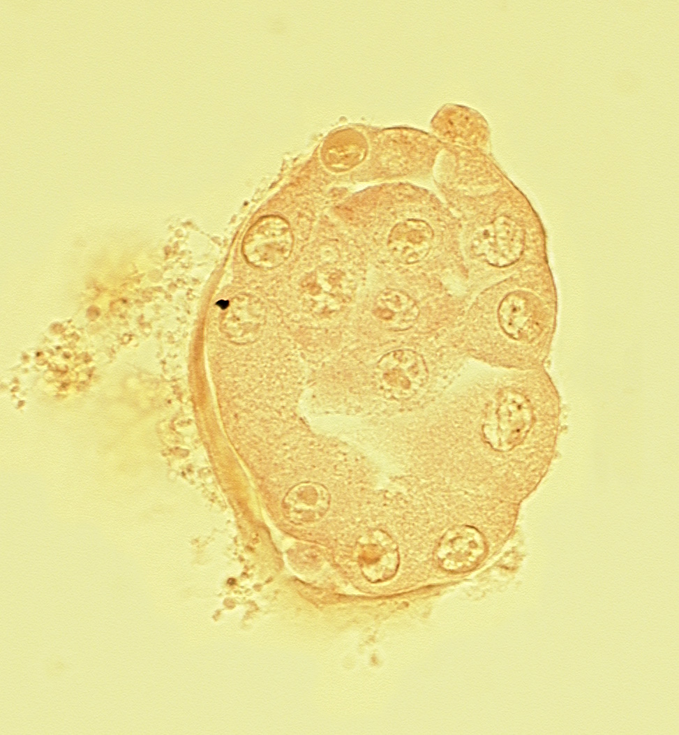 blastocystic cavity (blastocoele), disrupted zona pellucida, inner cell mass (embryoblast), mural trophoblast, polar body, polar trophoblast
