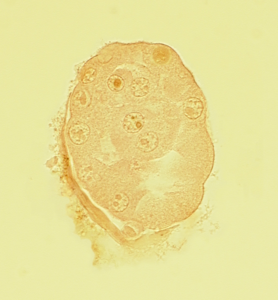 abembryonic pole, disrupted zona pellucida, embryonic pole, inner cell mass (embryoblast), polar body, polar trophoblast, subzonal space, trophoblast