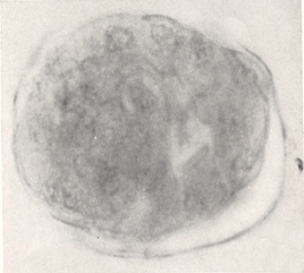 Embryo 8794