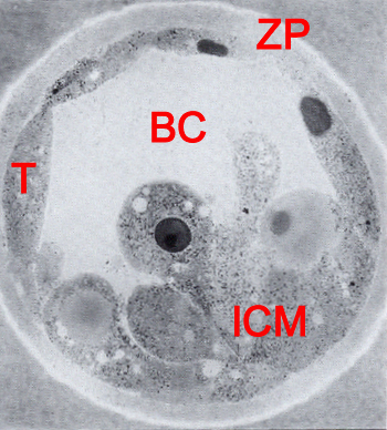 Blastocystic cavity (blastocoele), inner cell mass (embryoblast), trophoblast, and zona pellucida