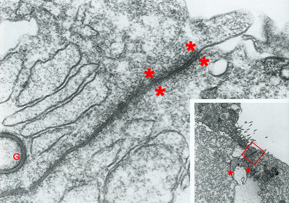 Apical tight junction between two trophoblast cells