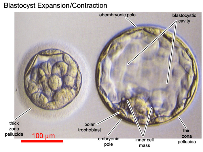 Expansion and contraction