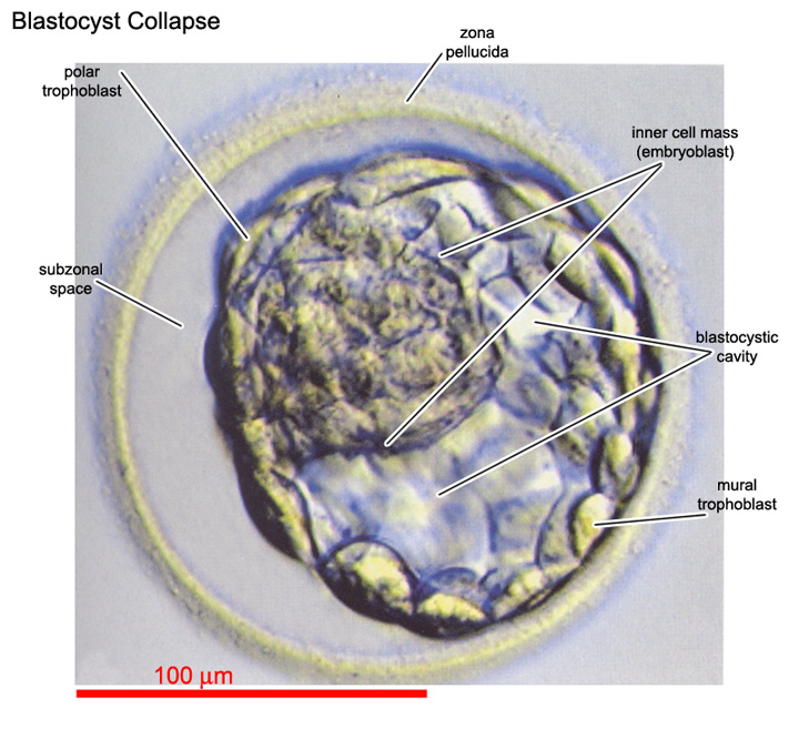 Blastocystic cavity (blastocoele) partially collapsed