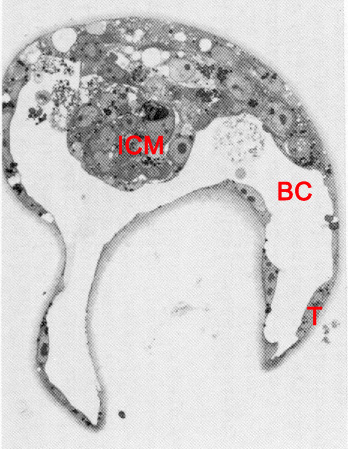 A section through inner cell mass (embryoblast) of an expanded embryo