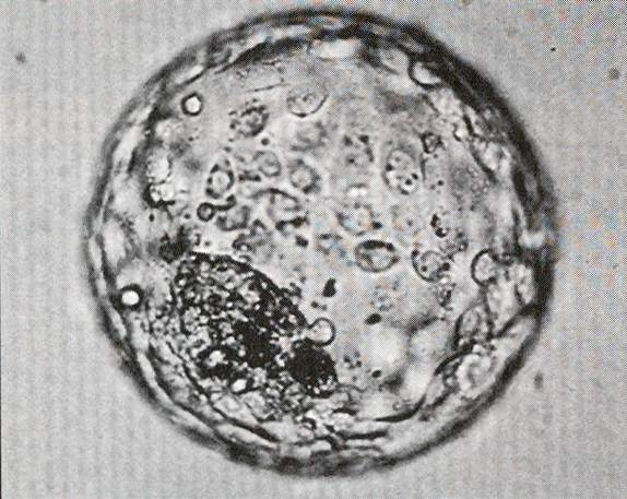 Embryo before hatching