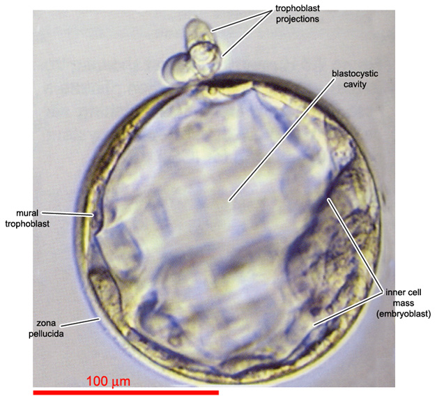 Trophoblast projections