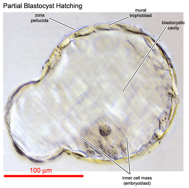 Partially hatched embryo