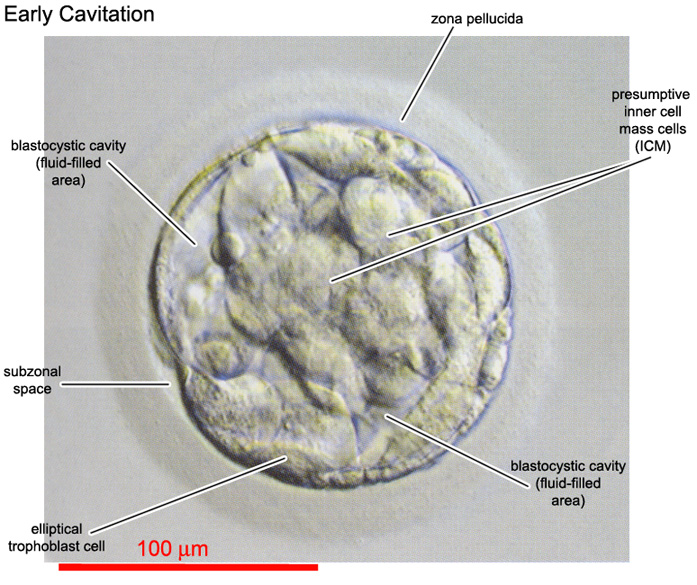 Early cavitation