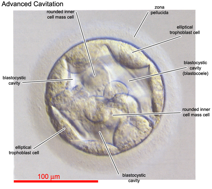 Advanced cavitation