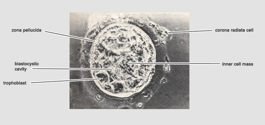 In vivo embryo