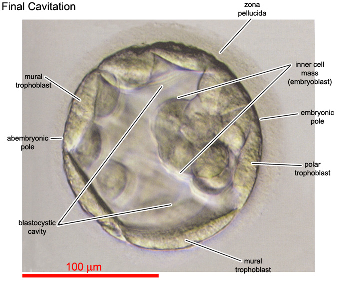 Final cavitation