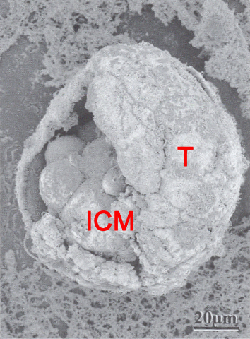 Inner cell mass (embryoblast) and trophoblast