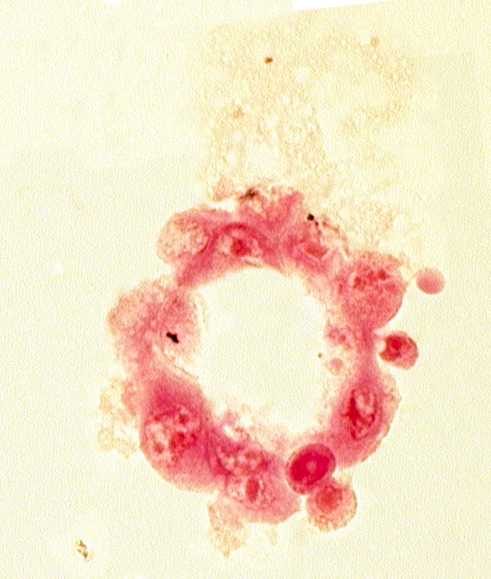 blastocystic cavity (blastocoele), mural trophoblast, polar trophoblast