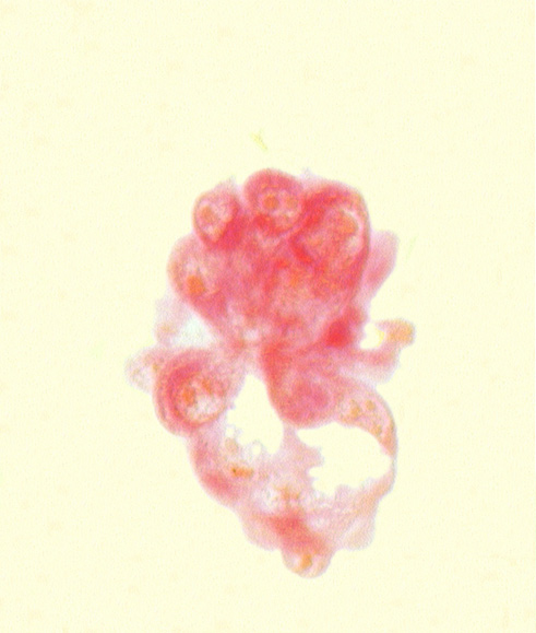 abembryonic pole, edge of blastocystic cavity (blastocoele), edge of inner cell mass (embryoblast), embryonic pole, mural trophoblast, polar trophoblast