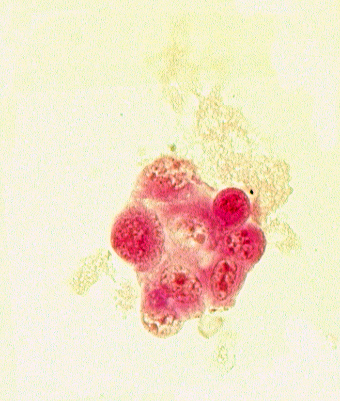 edge of blastocystic cavity (blastocoele), mural trophoblast