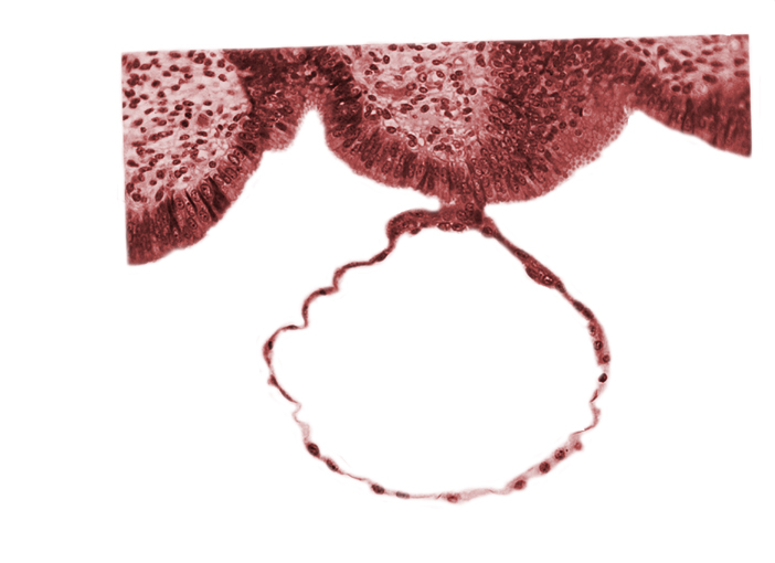 blastocystic cavity (blastocoele), contact area(s), endometrial (uterine) epithelium, endometrial (uterine) stroma, mural trophoblast