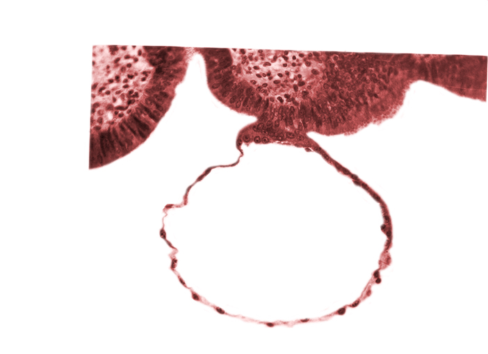 blastocystic cavity (blastocoele), contact area(s), mural trophoblast