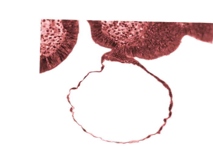 blastocystic cavity (blastocoele), contact area(s), mural trophoblast