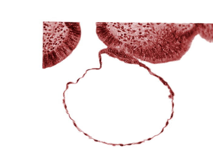 blastocystic cavity (blastocoele), cytotrophoblast, erosion of endometrial epithelium, mural trophoblast, syncytiotrophoblast