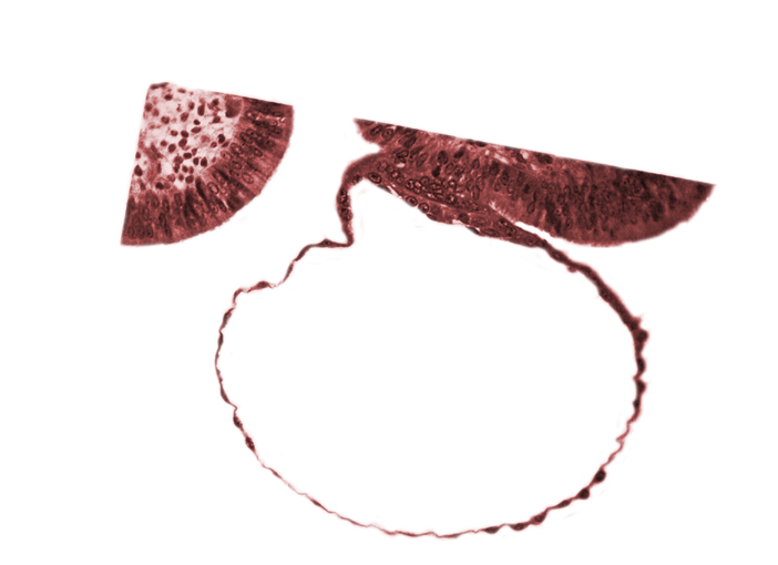 blastocystic cavity (blastocoele), cytotrophoblast, mural trophoblast, syncytiotrophoblast nuclei