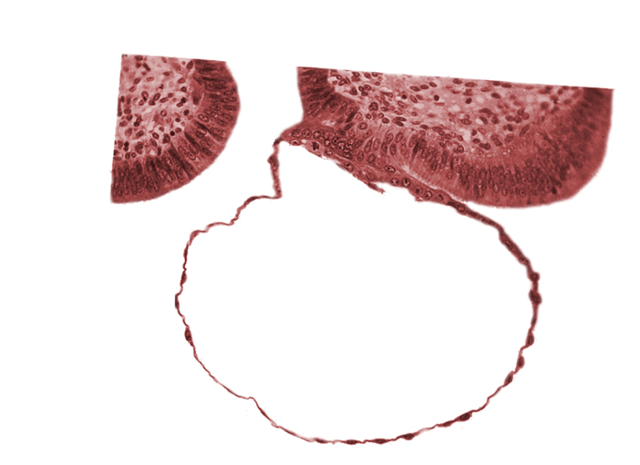 blastocystic cavity (blastocoele), cytotrophoblast, edematous endometrial stroma (decidua), endometrial (uterine) epithelium, mural trophoblast, syncytiotrophoblast