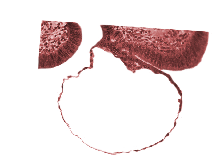 blastocystic cavity (blastocoele), contact area(s), edge of embryonic disc, mural trophoblast