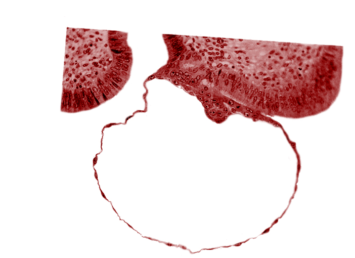 blastocystic cavity (blastocoele), contact area(s), embryonic disc, erosion of endometrial epithelium, mural trophoblast, syncytiotrophoblast