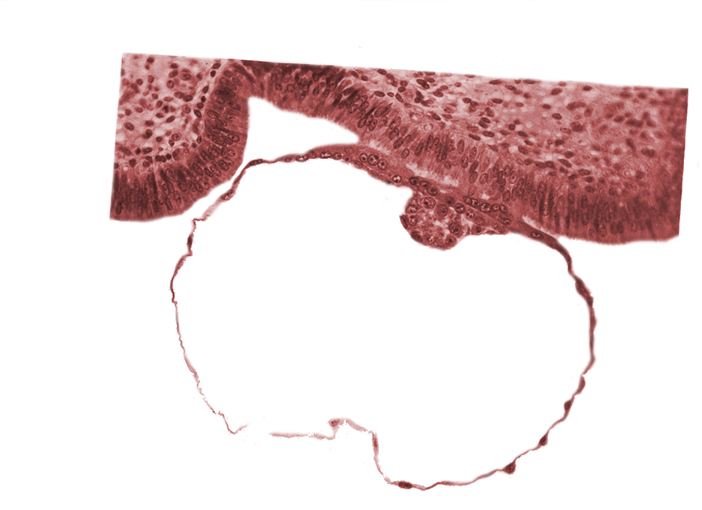 blastocystic cavity (blastocoele), contact area(s), embryonic disc, mural trophoblast, primordium of amniotic cavity