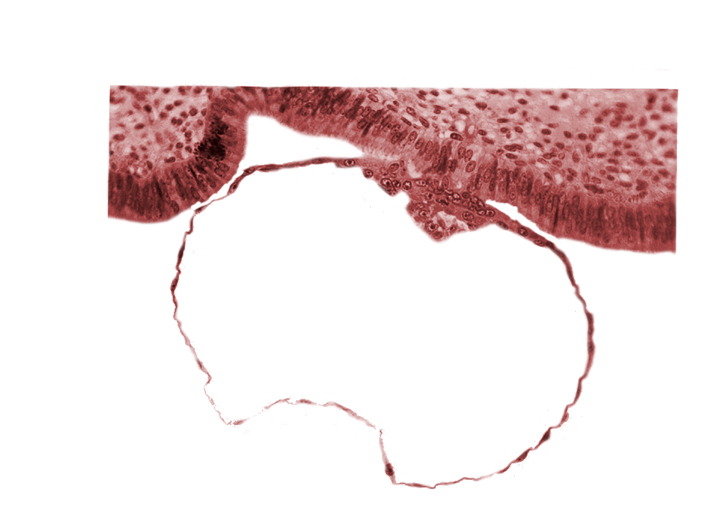 amniogenic cell, blastocystic cavity (blastocoele), edge of contact area, embryonic disc, mural trophoblast, primordium of amniotic cavity, syncytiotrophoblast