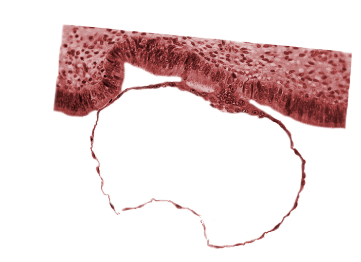 contact area(s), cytotrophoblast, edge of embryonic disc, syncytiotrophoblast nuclei