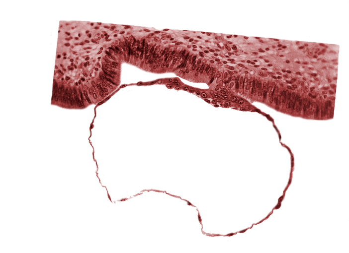 blastocystic cavity (blastocoele), cytotrophoblast nuclei, mural trophoblast