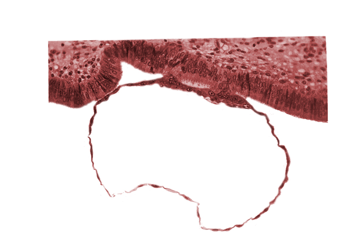 blastocystic cavity (blastocoele), contact area(s), cytotrophoblast, mural trophoblast, syncytiotrophoblast