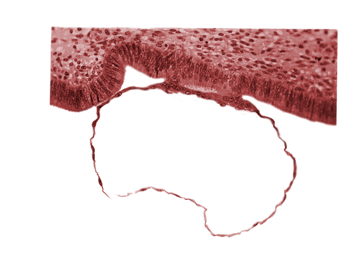 contact area(s), cytotrophoblast, endometrial (uterine) epithelium, endometrial (uterine) stroma, syncytiotrophoblast