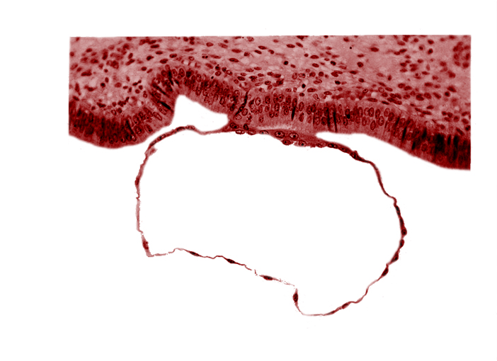 blastocystic cavity (blastocoele), contact area(s), cytotrophoblast, mural trophoblast, syncytiotrophoblast