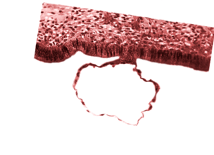 blastocystic cavity (blastocoele), contact area(s), mural trophoblast