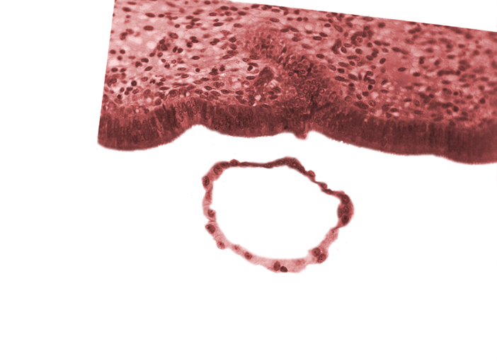 blastocystic cavity (blastocoele), polar trophoblast, tangentially cut mural trophoblast, uterine cavity