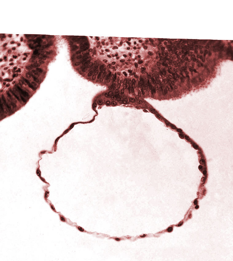 blastocystic cavity (blastocoele), contact area(s), mural trophoblast