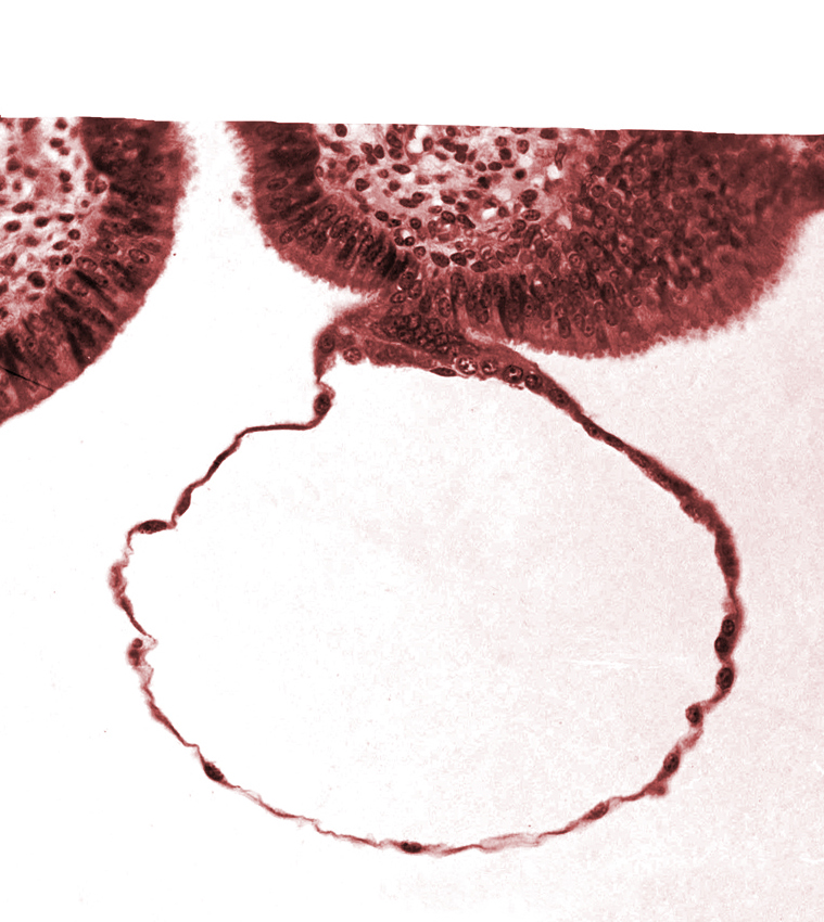 blastocystic cavity (blastocoele), contact area(s), mural trophoblast