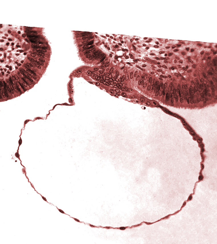 blastocystic cavity (blastocoele), cytotrophoblast, erosion of endometrial epithelium, mural trophoblast, syncytiotrophoblast