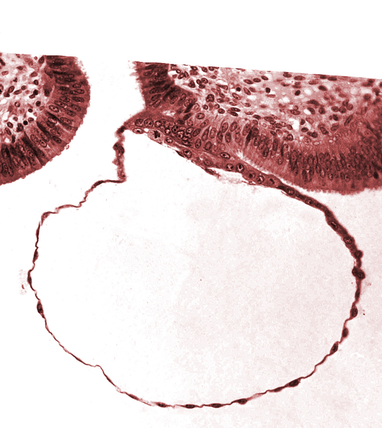 blastocystic cavity (blastocoele), cytotrophoblast, edematous endometrial stroma (decidua), endometrial (uterine) epithelium, mural trophoblast, syncytiotrophoblast