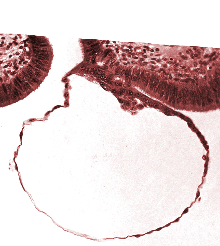 blastocystic cavity (blastocoele), contact area(s), edge of embryonic disc, mural trophoblast