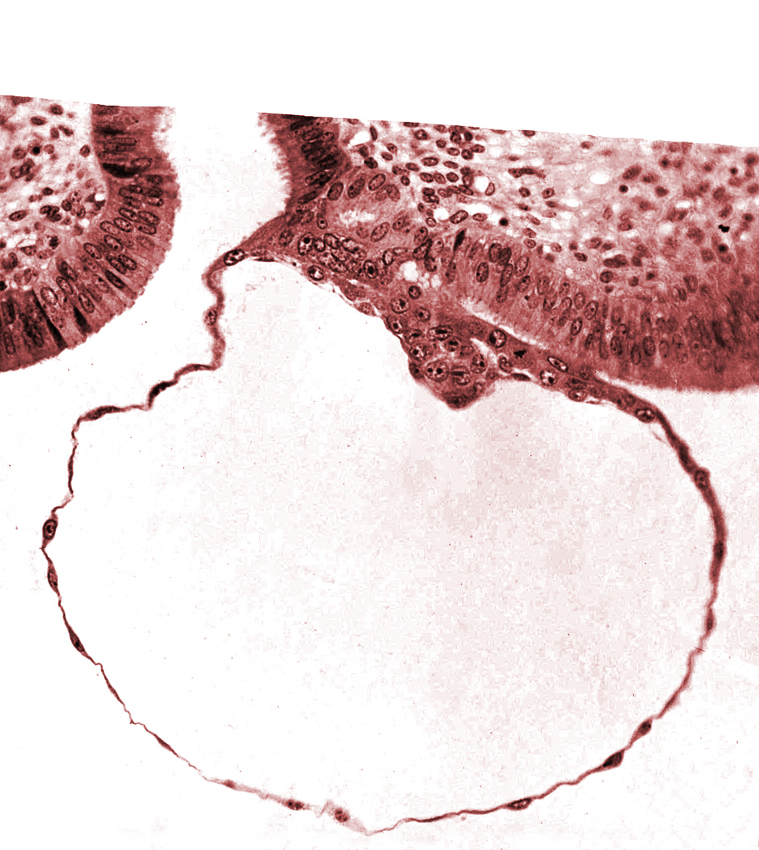 blastocystic cavity (blastocoele), contact area(s), embryonic disc, erosion of endometrial epithelium, mural trophoblast, syncytiotrophoblast