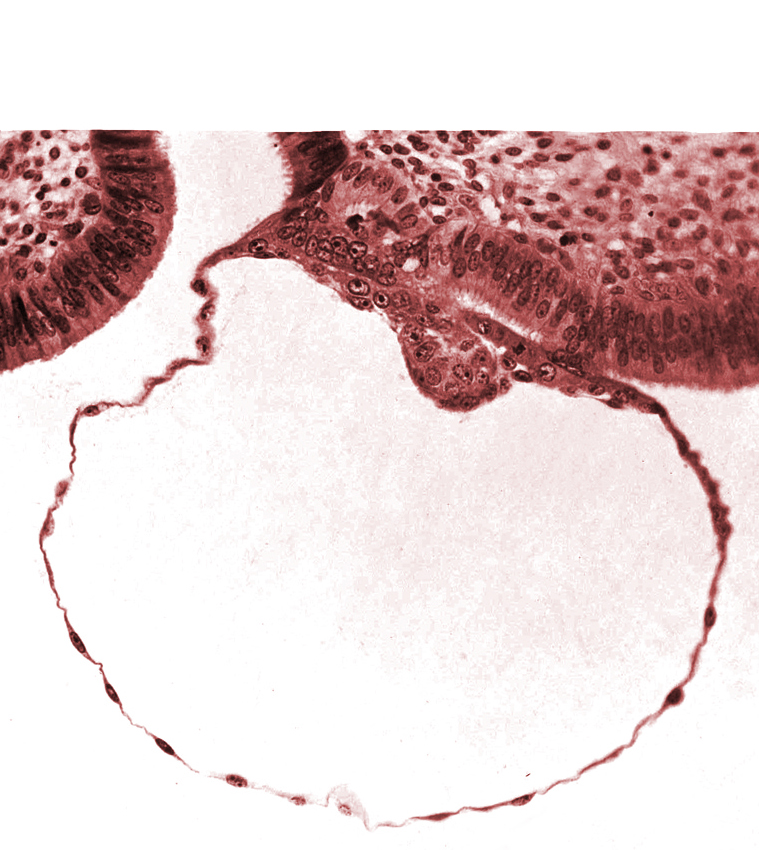 blastocystic cavity (blastocoele), contact area(s), embryonic disc, gap in contact area, mural trophoblast, syncytiotrophoblast nuclei